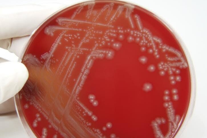 Last fall’s E. coli recall: a reminder of what went wrong